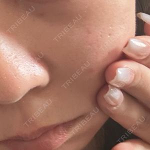 ルラ美容クリニック ルラ美容クリニック 札幌大通り院口コミ