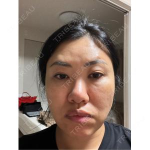 TCB東京中央美容外科 TCB東京中央美容外科 福岡博多院口コミ