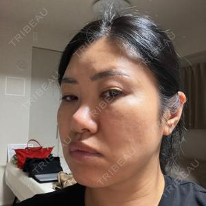TCB東京中央美容外科 TCB東京中央美容外科 福岡博多院口コミ
