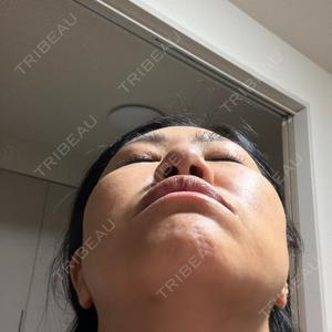 TCB東京中央美容外科 TCB東京中央美容外科 福岡博多院口コミ