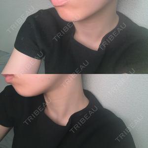 ビラビューティークリニック 博多美容外科/美容皮膚科 ビラビューティークリニック口コミ