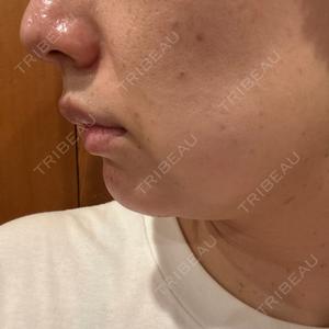 ルラ美容クリニック ルラ美容クリニック 岐阜院口コミ