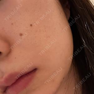 Fellez Clinic【フェルズクリニック】口コミ