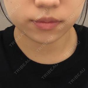 DMTC CLINIC DMTC美容皮膚科 大宮院口コミ