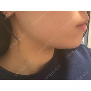 DMTC CLINIC DMTC美容皮膚科 大宮院口コミ
