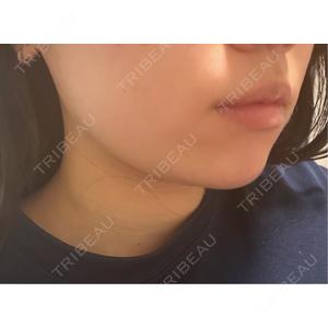 DMTC CLINIC DMTC美容皮膚科 大宮院口コミ