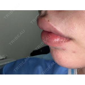 ビラビューティークリニック 博多美容外科/美容皮膚科 ビラビューティークリニック口コミ
