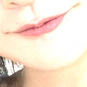 ARTE BEAUTY CLINIC口コミ