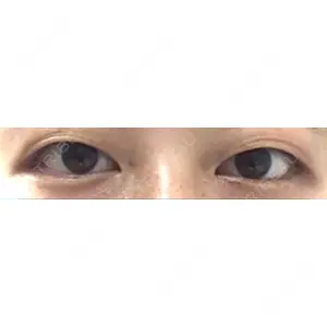 東京美容外科 東京美容外科 仙台院口コミ