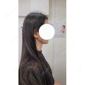 フィラークリニック フィラークリニック 渋谷院口コミ