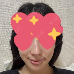 Chloe Cheongdam Clinic （クロエチョンダムクリニック）口コミ