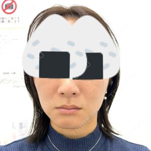 TCB東京中央美容外科 TCB東京中央美容外科 銀座有楽町院口コミ