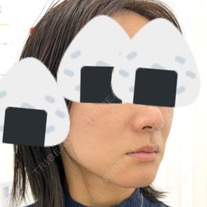 TCB東京中央美容外科 TCB東京中央美容外科 銀座有楽町院口コミ
