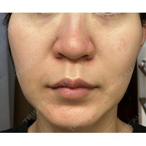 Natural Skin Clinic Natural Skin Clinic 自由ヶ丘院口コミ