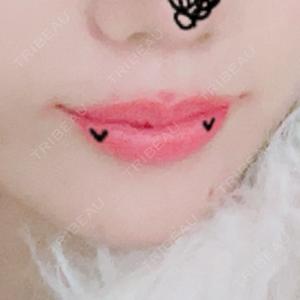 ルラ美容クリニック ルラ美容クリニック 札幌大通り院口コミ