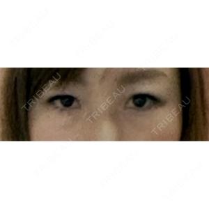 湘南美容クリニック 湘南美容クリニック 千葉センシティ院口コミ