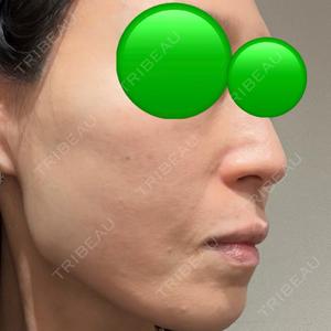 BITO BEAUTY CLINIC BITO BEAUTY CLINIC口コミ