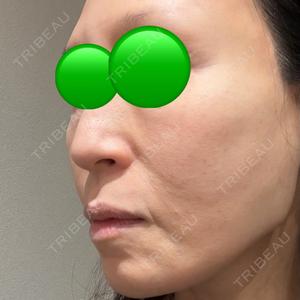 BITO BEAUTY CLINIC BITO BEAUTY CLINIC口コミ