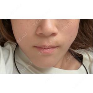 DMTC CLINIC DMTC美容皮膚科 大宮院口コミ