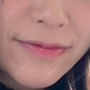 フィラークリニック フィラークリニック 渋谷院口コミ