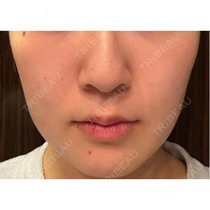 Chloe Cheongdam Clinic （クロエチョンダムクリニック）口コミ