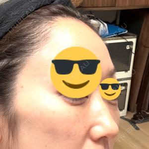 湘南美容クリニック 湘南美容クリニック 池袋西口院口コミ