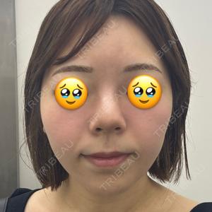 ARTE BEAUTY CLINIC口コミ