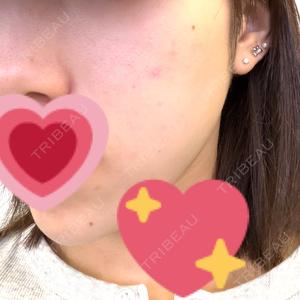 ルラ美容クリニック ルラ美容クリニック 千葉院 / ルラスキンクリニック 千葉院口コミ