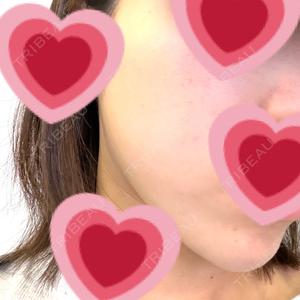ルラ美容クリニック ルラ美容クリニック 千葉院 / ルラスキンクリニック 千葉院口コミ