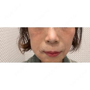 CLEAN BEAUTY CLINICの口コミ