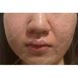 CLEAN BEAUTY CLINICの口コミ
