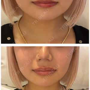 麻布十番クレールデンタルクリニック口コミ