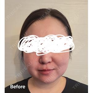 Lipo Clinic omotesandoの