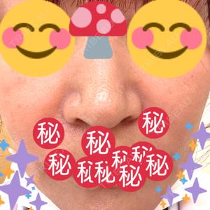 NARU Beauty Clinic NARU Beauty Clinic 【ナルクリ】口コミ