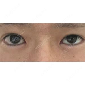NARU Beauty Clinic NARU Beauty Clinic 【ナルクリ】口コミ