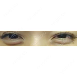 AYANAフィラーズクリニック AYANAフィラーズクリニック 渋谷院口コミ