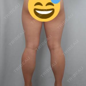 プチパーティー医院口コミ