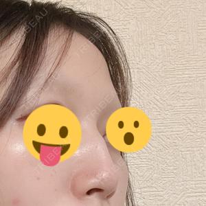 ルラ美容クリニック ルラ美容クリニック 上野院口コミ