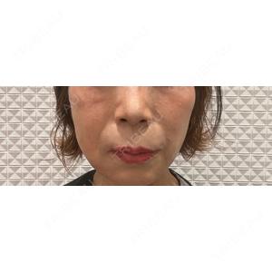 CLEAN BEAUTY CLINICの口コミ