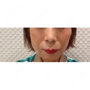 CLEAN BEAUTY CLINICの口コミ