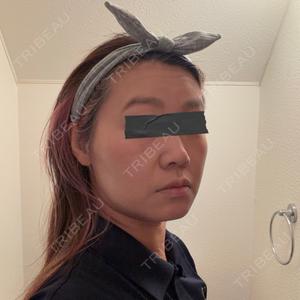 湘南美容クリニック 湘南美容クリニック 秋葉原院口コミ