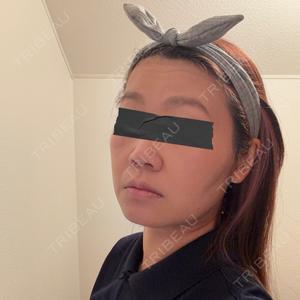 湘南美容クリニック 湘南美容クリニック 秋葉原院口コミ