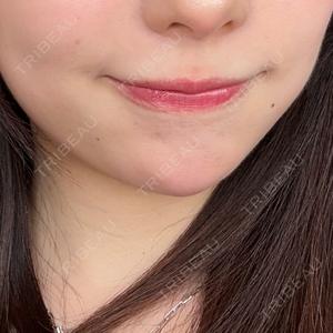DMTC CLINIC DMTC美容皮膚科 大宮院口コミ