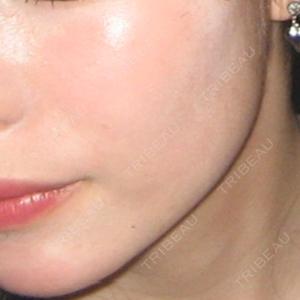 DMTC CLINIC DMTC美容皮膚科 大宮院口コミ