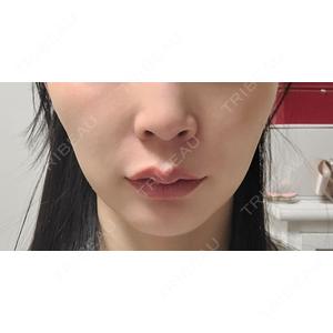 Chloe Cheongdam Clinic （クロエチョンダムクリニック）口コミ