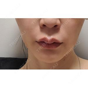 Chloe Cheongdam Clinic （クロエチョンダムクリニック）口コミ