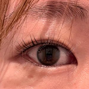 NARU Beauty Clinic NARU Beauty Clinic 【ナルクリ】口コミ