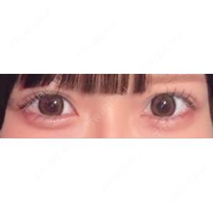 口コミ