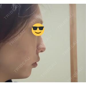 東京形成美容外科 東京形成美容外科 銀座院口コミ