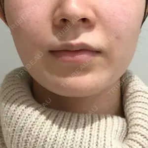 Beauty Connection Ginza Clinic（BCGクリニック）口コミ
